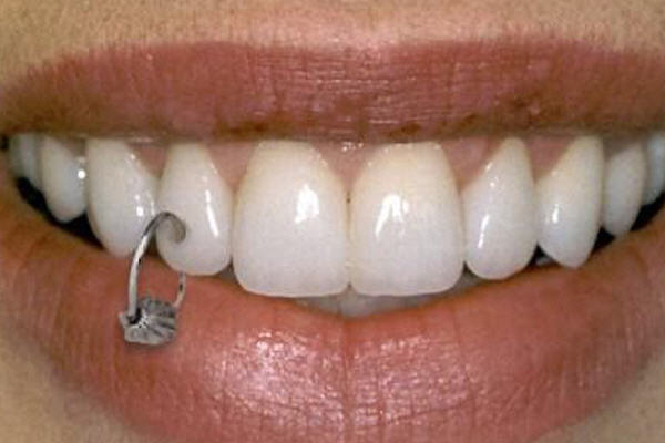 modas dentales _piercing dentales