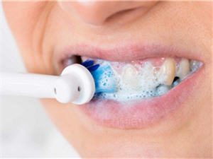 Blanqueamiento Dental_cepillos eléctricos